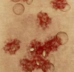 �۳������������ֲ�����